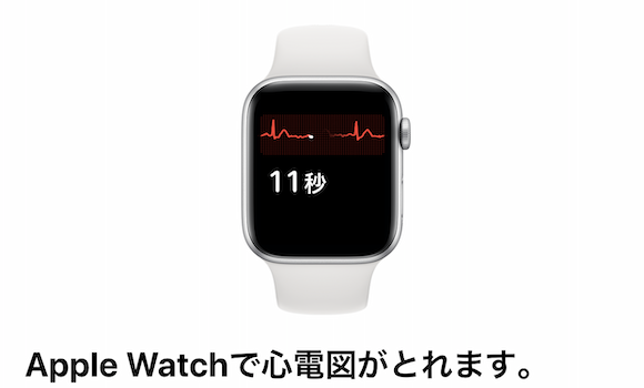 Apple Watch ECG 心電図