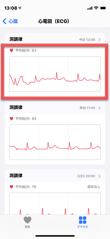 iPhone Apple Watch 心電図 アプリ