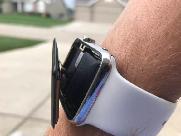 バッテリーが膨張して画面が外れたApple Watch