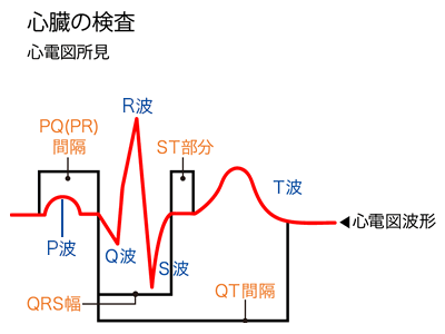 electrocardiogram_QT