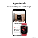 Apple Watch ECG 0117_3