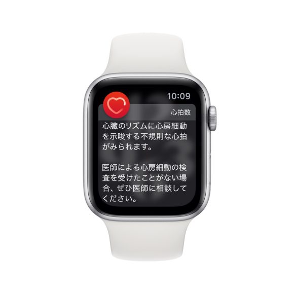 Apple_watch-alerts-heartrate-atrialfibrillation-longlook_inline.jpg.large_2x_1200