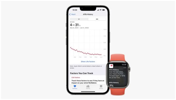 Apple Watchの心房細動履歴機能、日本で承認取得！watchOS11で解禁？