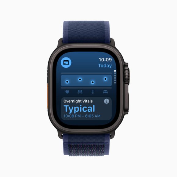 watchos11