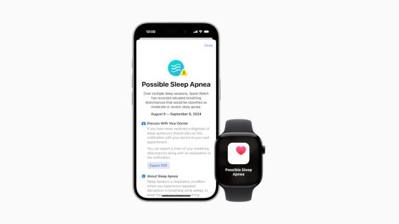 Apple Watchの睡眠時無呼吸通知、150カ国展開！