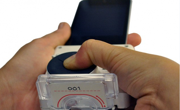 スマホ エイズ チェック HIV