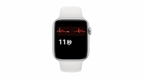 Apple Watch ECG 心電図