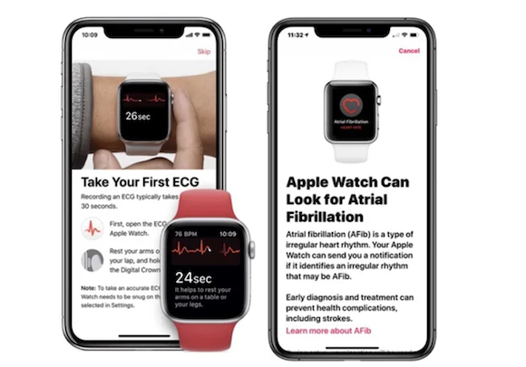 Apple Watch AFib