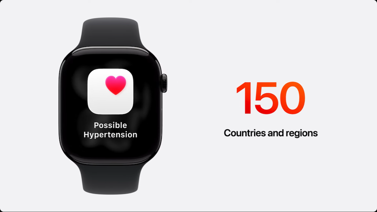 Apple Watch S11_3